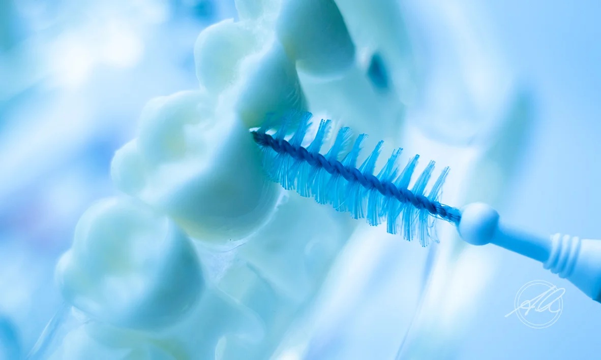Periodontal treatment at Prof Alex Quaranta's practice
